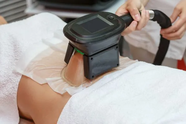 Image of person having fat freezing treatment to help weight gain Southam