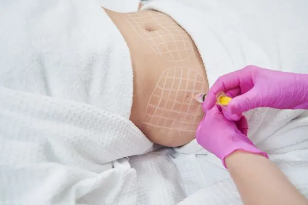 image of fat dissolving injections on love handles to help combat weight gain Southam