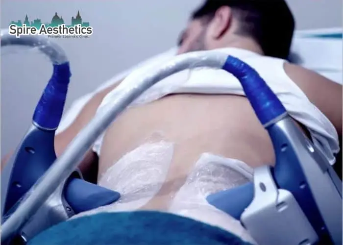 Man having fat freezing treatment done on love handles before a competitions Southam to create a sculpted look.