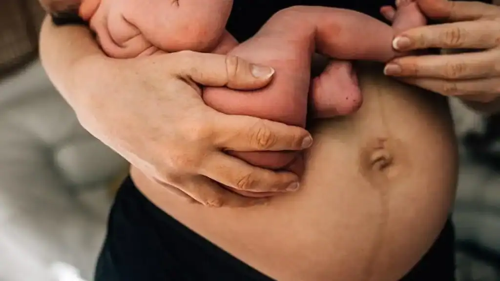 Why Is My Stomach Still Big After Pregnancy Southam?